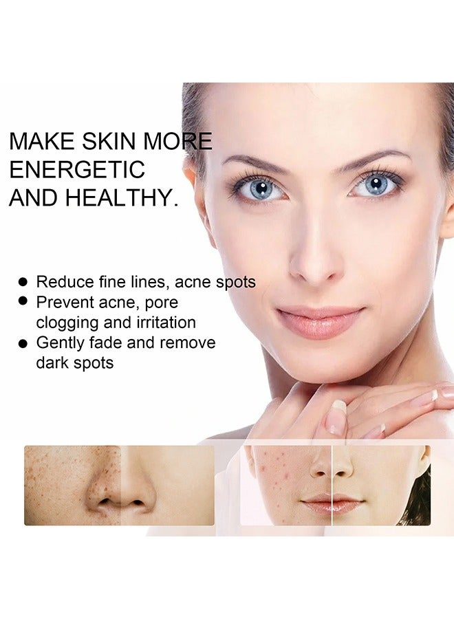 Whitening Freckle Cream,Dark Spot Corrector Remover Cream Whitening Moisturizing Brighten Complexion Improving Skin Barrier 20g