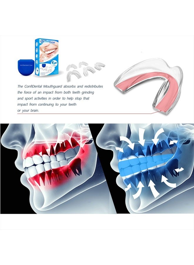 Pack of 5 Moldable Mouth Guard for Teeth Grinding Clenching Bruxism, Sport Athletic, Whitening Tray, Including 3 Regular and 2 Heavy Duty Guard (3 (lll) Regular 2 (II) Heavy Duty)