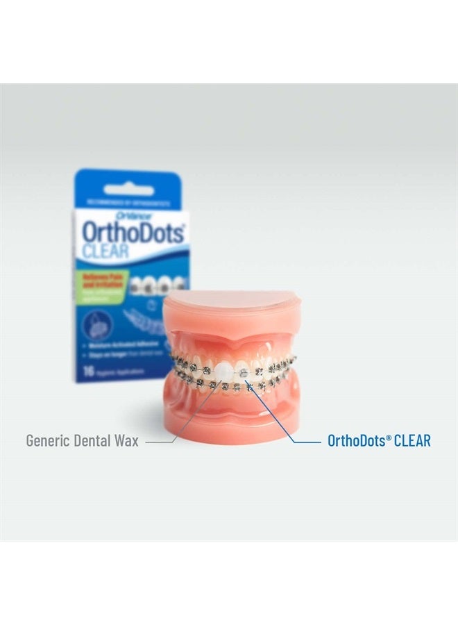 OrthoDots CLEAR – Moisture Activated Braces Wax Alternative for Pain Caused by Braces, Clear Aligner Trays, and Other Orthodontic Appliances. OrthoDots Stick Better and Stay on Longer than Dental Wax.