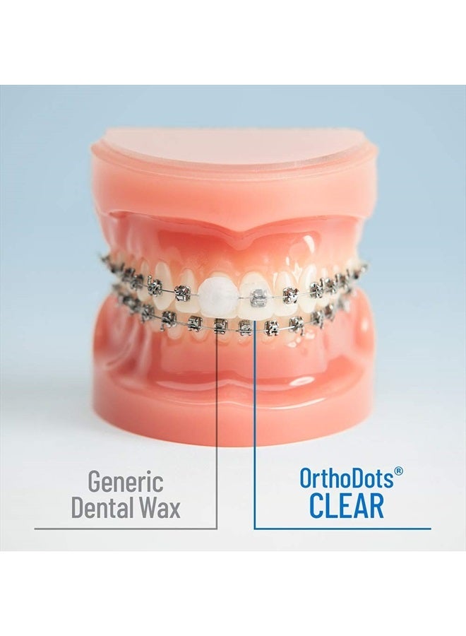 OrthoDots CLEAR – Moisture Activated Braces Wax Alternative for Pain Caused by Braces, Clear Aligner Trays, and Other Orthodontic Appliances. OrthoDots Stick Better and Stay on Longer than Dental Wax.