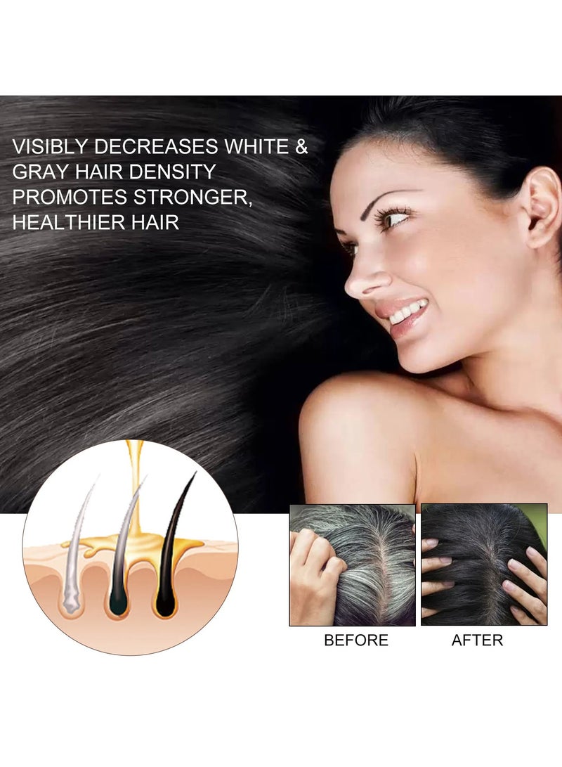 Fast Growth Hair Serum, Anti Hair Loss Hair Treatment Oil, Scalp Cure Nourish Strong Hair Roots Essence Oil, Effective Hair Regrowth Essential Oil For Damaged And Frizzy Hair