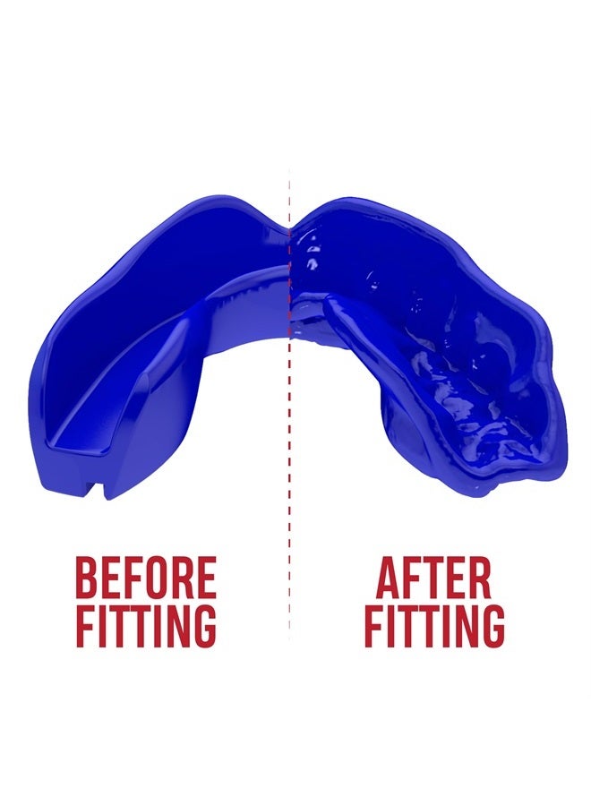 Mouthguard Slim Fit, Adults and Junior Mouth Guard with Case for Boxing, Basketball, Lacrosse, Football, MMA, Martial Arts, Hockey and All Contact Sports (Blue, Adult)