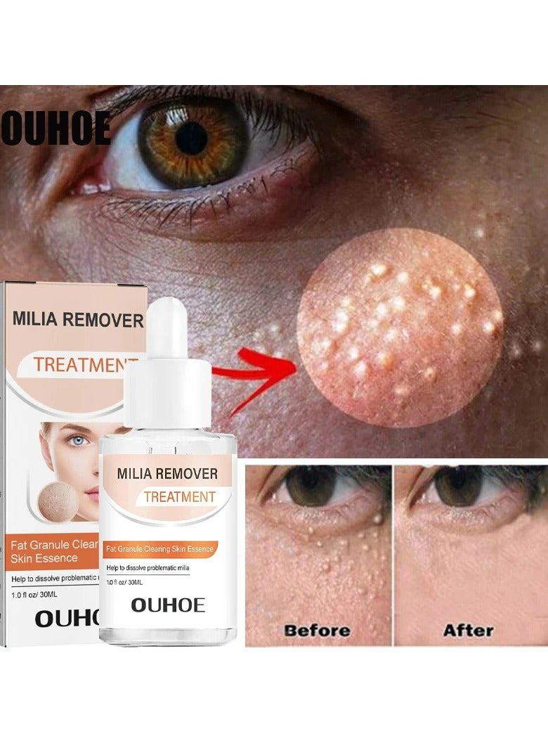 Milia Clearing Essence, Fat Granules Removal Eye Serum, Natural Formula Milia Remover Milia Spot Treatment, Anti Dark Circle Fade Fine Essence, Anti Puffiness Moisturizing Skin Care Serum