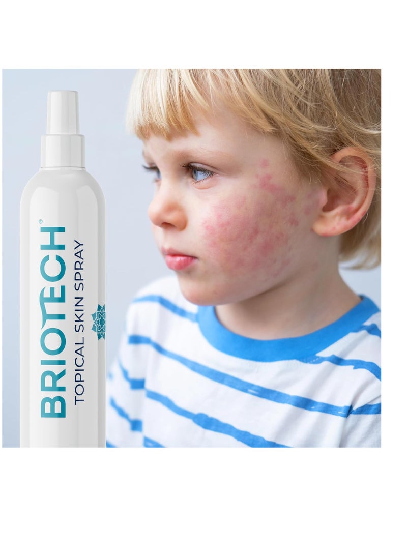 BRIOTECH Pure Hypochlorous Acid Spray, Multi Purpose Topical Body & Facial Mist, Eyelid Cleanser, Support Against Irritation & Redness Relief, Dry Skin & Scalp Treatment, Packaging May Vary, 8 fl oz