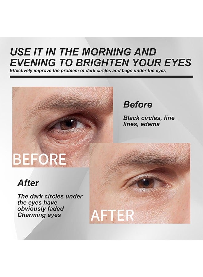 Under Eye Cream,Men's eye care products include an eye cream for dark circles and puffiness, as well as an anti-aging caffeine eye cream for men to lighten the skin and reduce puffiness, dark circles