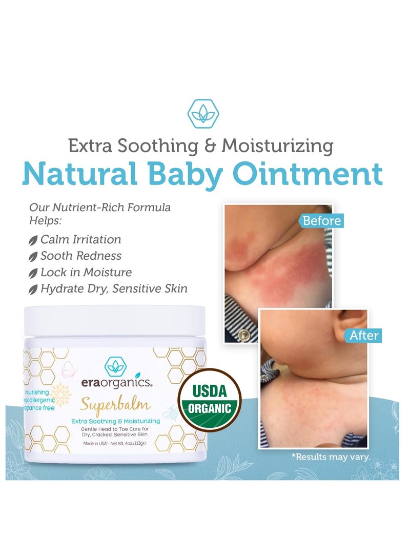 Era Organics Healing Ointment for Babies - USDA Certified Organic Natural Gentle Moisturizer for Sensitive Skin Prone To Baby Eczema, Cradle Cap (Infant Seborrheic Dermatitis), Rashes & Hives (4 oz.)