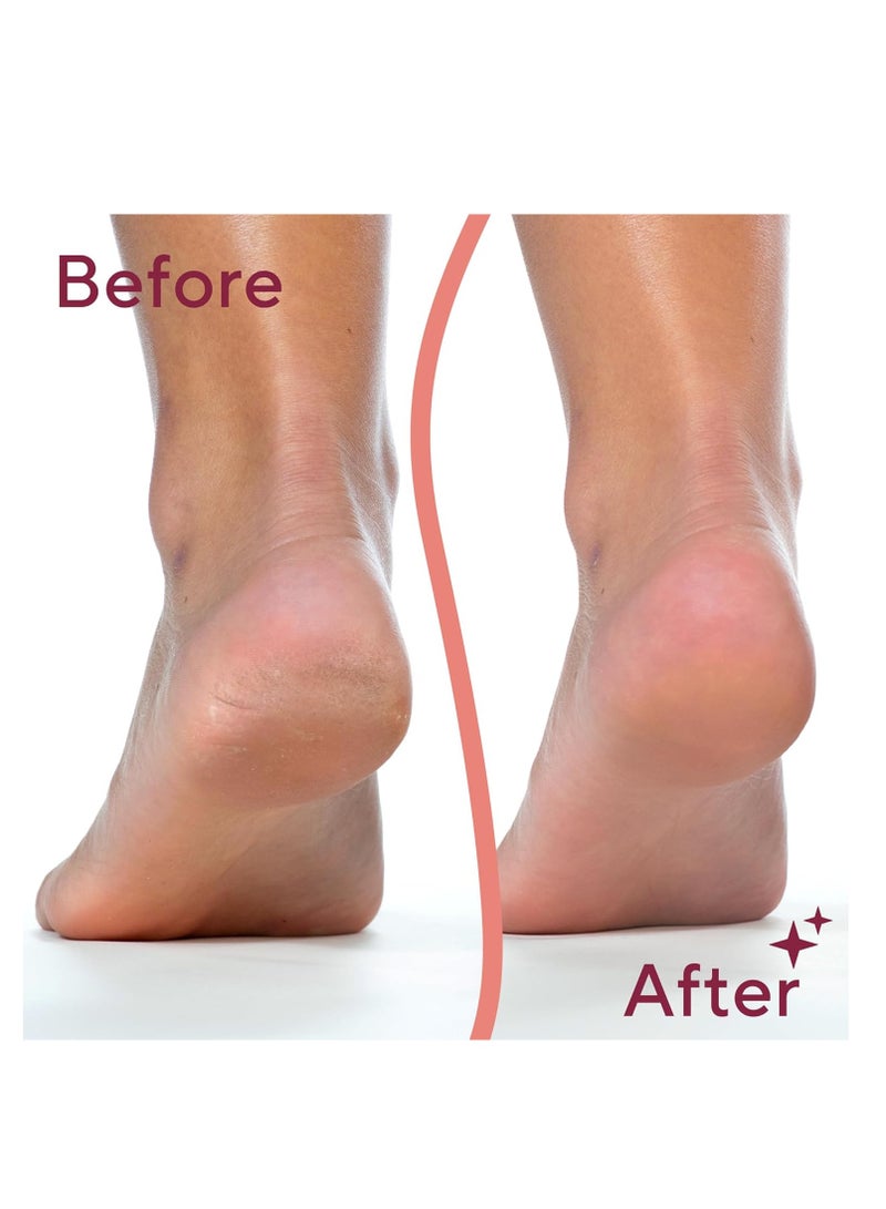 Pedi Electronic Tool File and Callus Remover, Pedicure-New Version