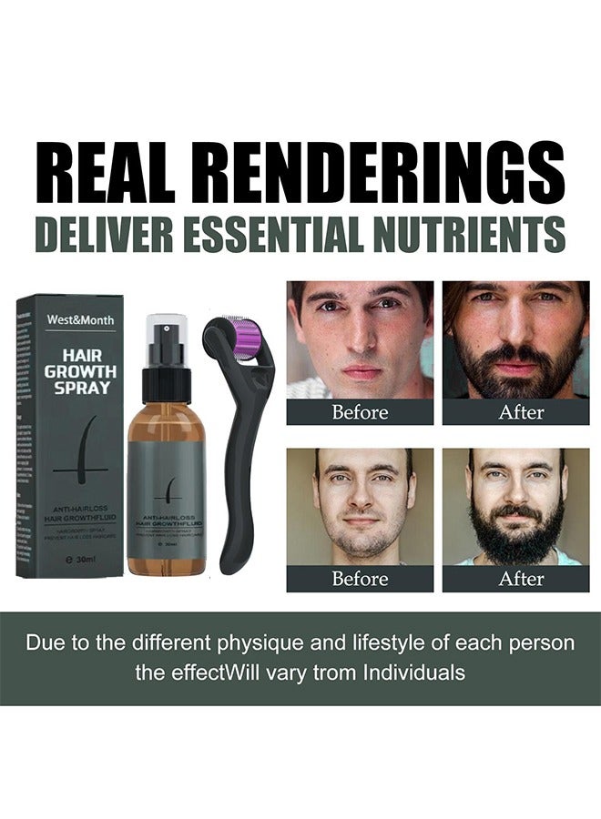 Hair Growth Spray-Beard Growth And Hair Regrowth Spray 30 ML With MicroNeedle Roller