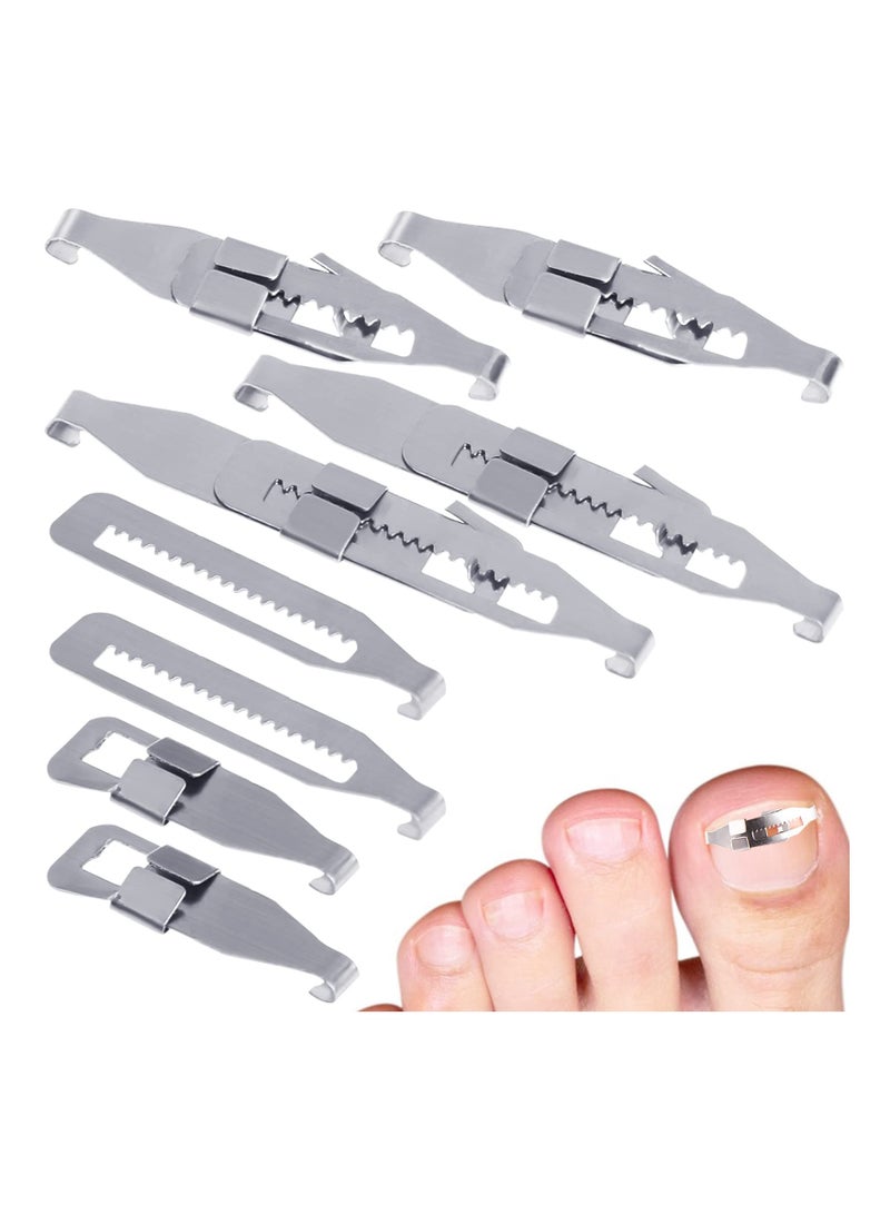 Ingrown Straightening Clips Toenail Pedicure Tool Curved Brace Toenails Thick Paronychia Correction Tool, Ingrowing Nail Treatment Kit, 2 Sizes 4 Pcs