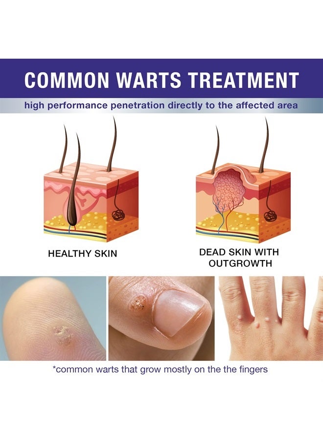 DrLuke Wart Corn Remover for Toes Feet: Fast Acting Plantar Wart Common Wart Flat Wart Corn Removal - Salicylic Acid Wart Corn Removal for Feet Toes Finger and Hand
