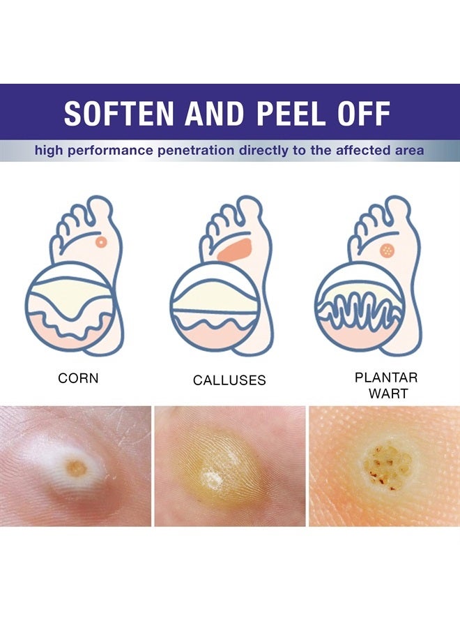 DrLuke Wart Corn Remover for Toes Feet: Fast Acting Plantar Wart Common Wart Flat Wart Corn Removal - Salicylic Acid Wart Corn Removal for Feet Toes Finger and Hand
