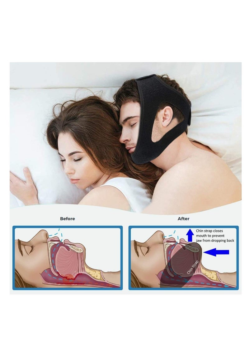 Anti Snoring Chin Strap, Stop Snoring, The Most Effective Snoring Solution, Snoring Reduction Relief Stopper, Sleep Aid Devices Adjustable Comfortable Bands For Men And Women