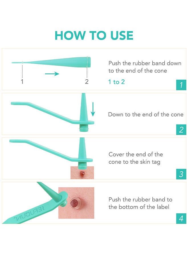 2 In 1 Skin Tag Removal Tool Kit Painless Easy-Using Device For Small To Large Sized Skin Tag On Face Neck And Body， Double Head Wart Removal Tool Skin Tag Removal Green