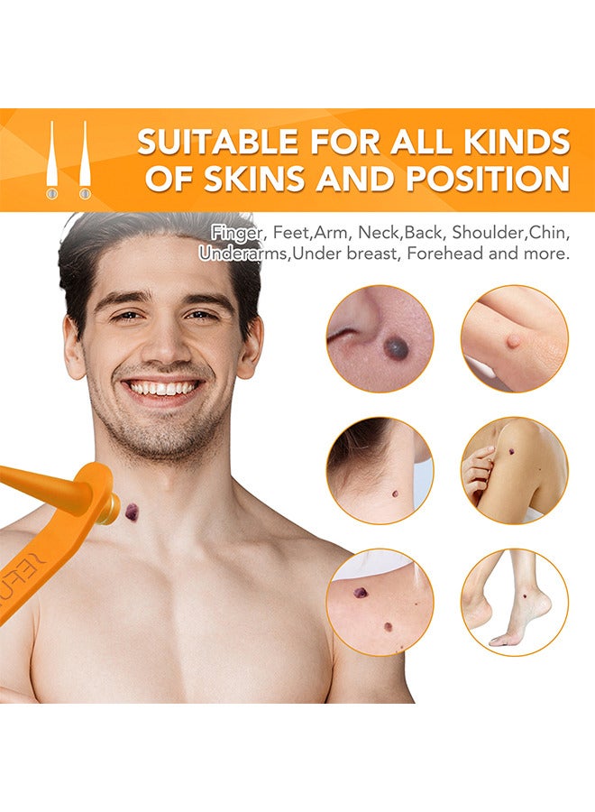 2 In 1 Skin Tag Removal Tool Kit Painless Easy-Using Device For Small To Large Sized Skin Tag On Face Neck And Body， Double Head Wart Removal Tool Skin Tag Removal Orange
