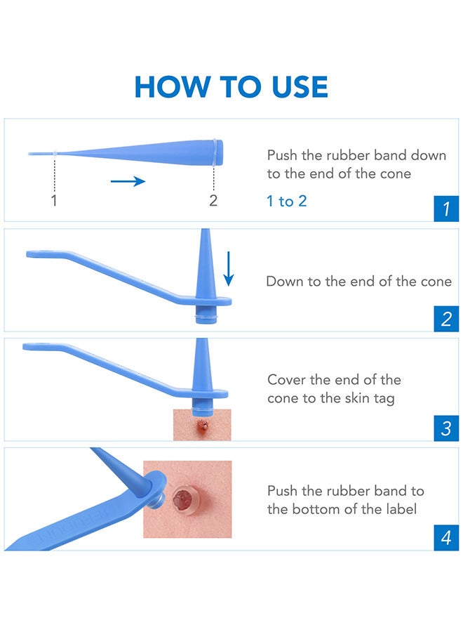 2 In 1 Skin Tag Removal Tool Kit Painless Easy-Using Device For Small To Large Sized Skin Tag On Face Neck And Body， Double Head Wart Removal Tool Skin Tag Removal Blue