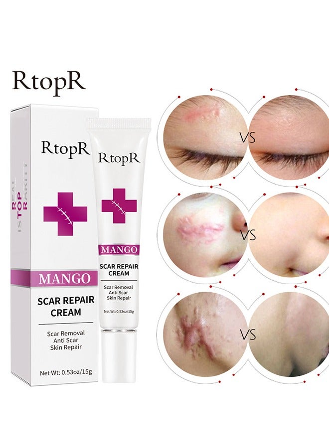 Scar Removal Cream Skin Repair Creams Treatment Stretch Marks Acne Surgical Care 15g