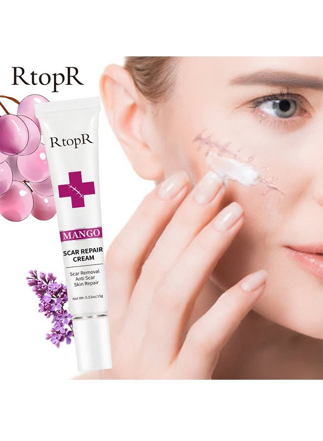 Scar Removal Cream Skin Repair Creams Treatment Stretch Marks Acne Surgical Care 15g