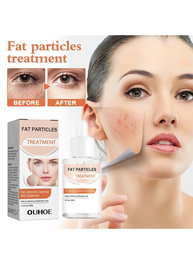 Fat Granule Clearing Skin Essence-Milia Removal Treatment, Milia Spot Treatment Helps Dissolve And Reduce Milia, Whitehead And Sebaceous Hyperplasia, Cysts And Sebaceous Hyperplasia Face Serum 30ml