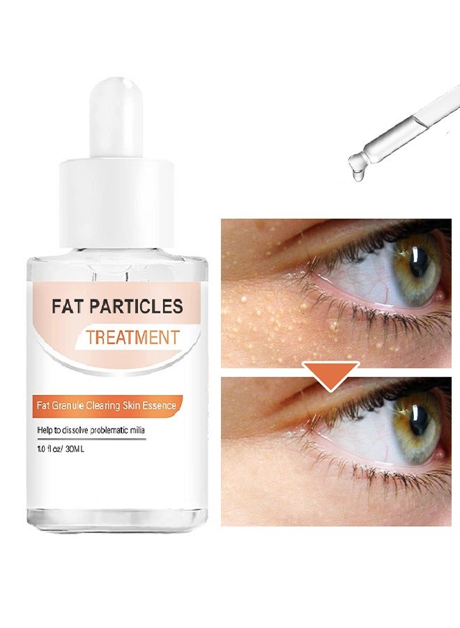Fat Granule Clearing Skin Essence-Milia Removal Treatment, Milia Spot Treatment Helps Dissolve And Reduce Milia, Whitehead And Sebaceous Hyperplasia, Cysts And Sebaceous Hyperplasia Face Serum 30ml