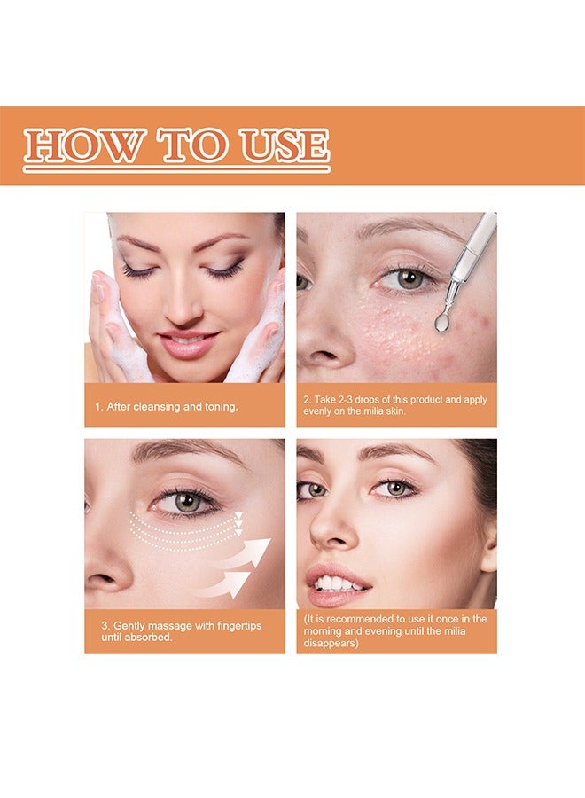 Fat Granule Clearing Skin Essence-Milia Removal Treatment, Milia Spot Treatment Helps Dissolve And Reduce Milia, Whitehead And Sebaceous Hyperplasia, Cysts And Sebaceous Hyperplasia Face Serum 30ml