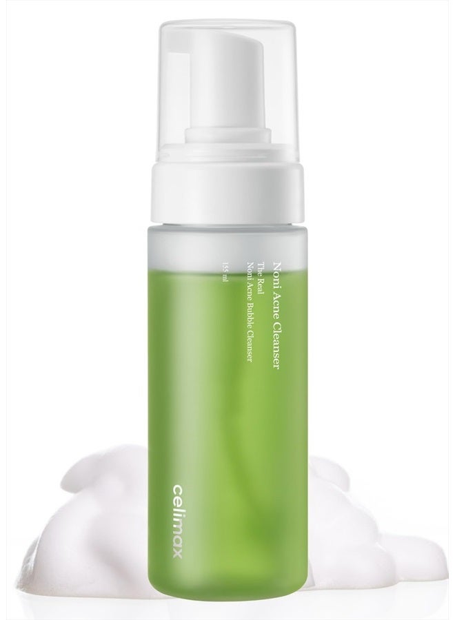 Noni Acne Bubble Cleanser | Mild Formula Face Wash for Sensitive to Oily Dry Combination Skin Calming, Soothing, Exfoliating, 155ml