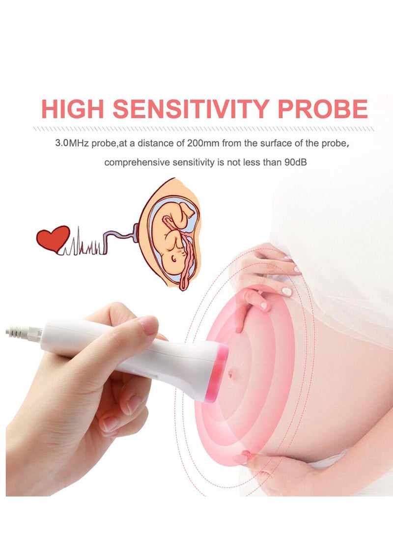 Fetal Doppler Detector， Baby Heart Beat Rate Probe ，Prenatal Monitor Ultrasonic。