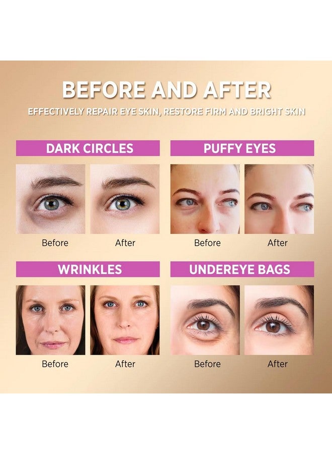 Under Eye Patches For Dark Circles Eye Masks With Collagen Reduce Puffy Eyes Wrinkles