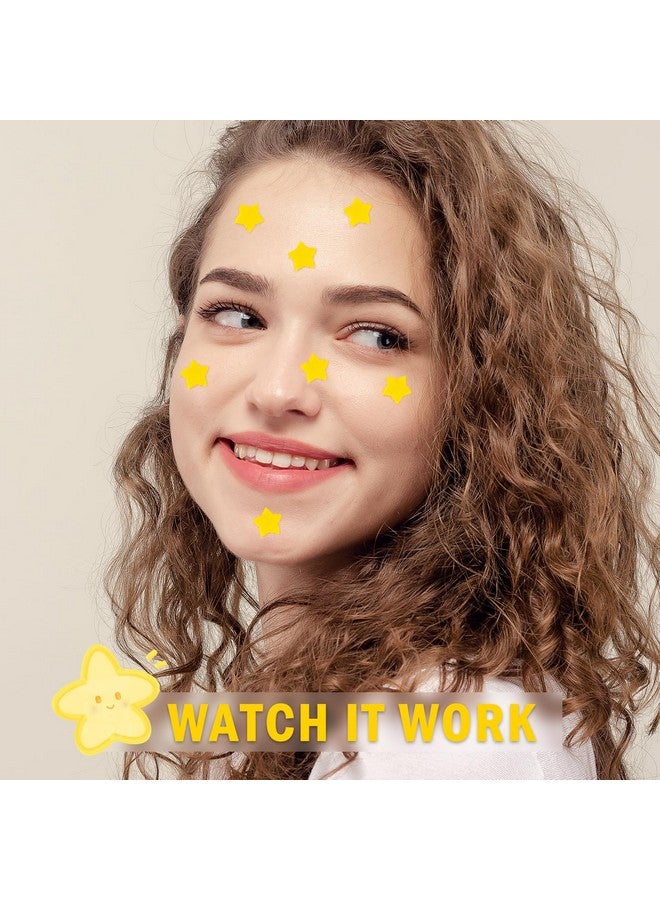 Star Pimple Patches 150 Count Hydrocolloid Pimple Patchescute Star Shape Yellow Colorspot Stickers For Face And Skintemporary Mirror