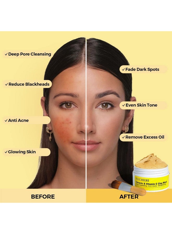 Turmeric Vitamin C Clay Mask Blackheads Acne Dark Spots Remover With Turmeric Extract Turmeric Clay Mud Mask For Glowing Skin Refining Pores And Controlling Oil