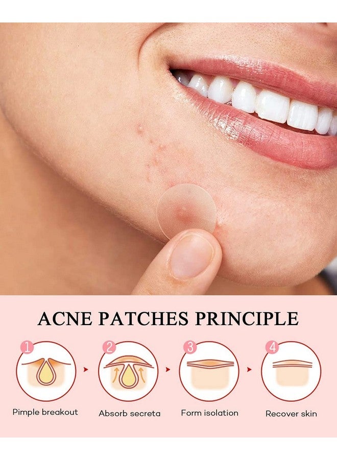 Pimple Patches Acne Patches For Face 4 Sizes 352 Patches Hydrocolloid Acne Cover Patch Clear Easy To Peel Acne Absorbing Zit Patch With Tea Tree & Calendula Oil