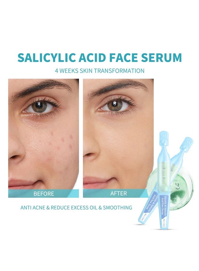 Salicylic Acid Serum For Face With Glycolic Acid Azelaic Acid Redness Relief Hydrating & Smoothing Serum Anti Aging Facial Serum 30 Ampoules