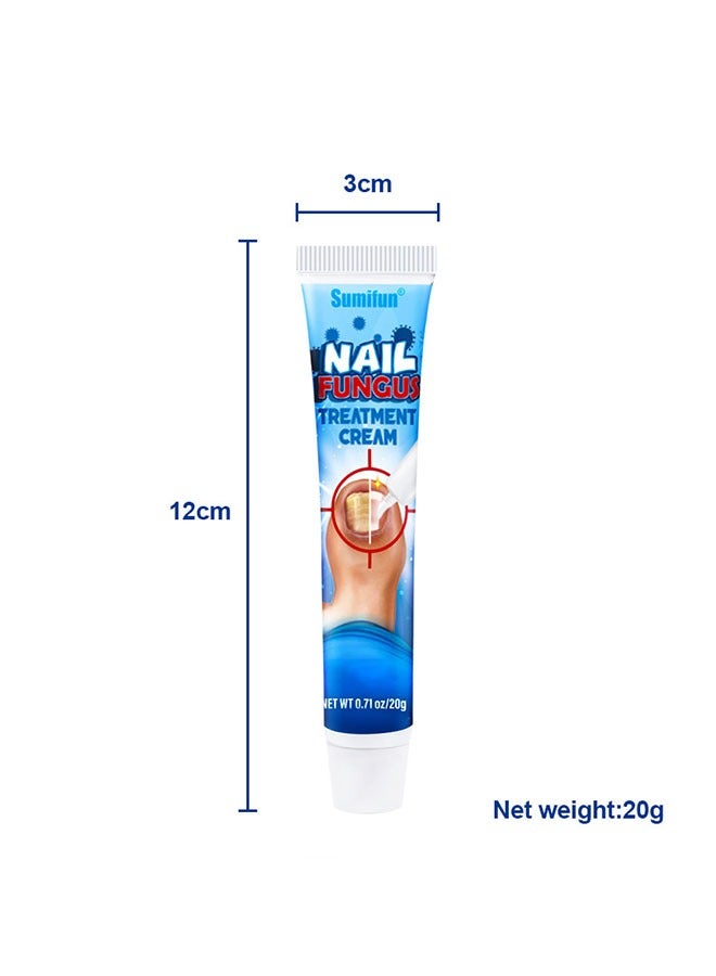 Nail Fungus Treatment Cream 20g, Bad Nail Care Ointment, Nail Fungus Treatment, Nail Growth and Repair, Nail Treatment Repair Cream