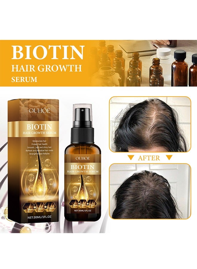 Biotin Hair Serum, Hair Regrowth Spray, Biotin Thickening Herbal Serum, Anti Hair Loss Serum For Hair Growth And Hair Loss, Hair Regrowth For Thicker Longer Fuller Hai 30ml