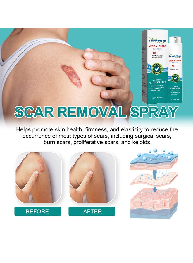 Scar Care Spray Burns Scars Stretch Marks Fade Scars Smooth Skin 20G