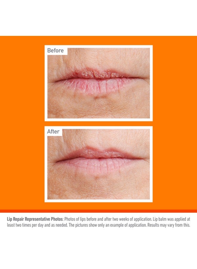 Cooling Relief Lip Repair Lip Balm For Dry Cracked Lips Stick (Pack Of 1)