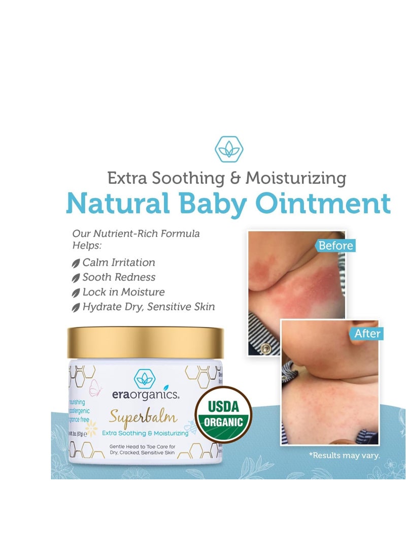 Era Organics Healing Ointment for Babies - USDA Certified Organic Natural Gentle Moisturizer for Sensitive Skin Prone To Baby Eczema, Cradle Cap (Infant Seborrheic Dermatitis), Rashes, Hives & More