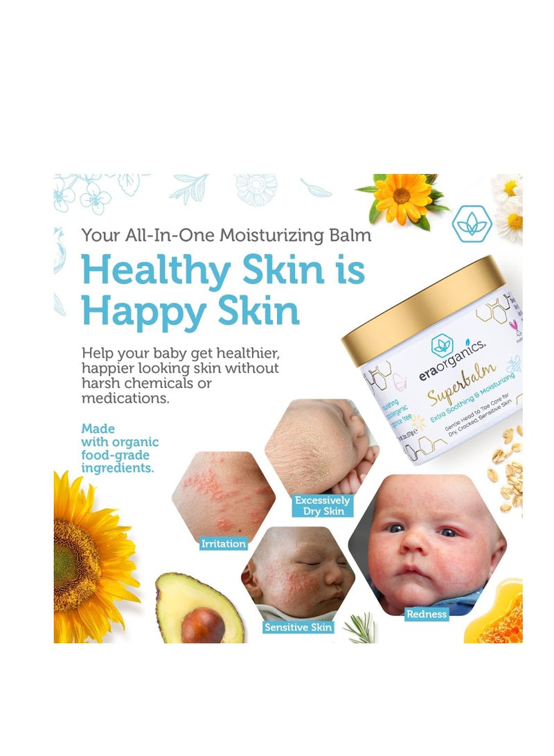 Era Organics Healing Ointment for Babies - USDA Certified Organic Natural Gentle Moisturizer for Sensitive Skin Prone To Baby Eczema, Cradle Cap (Infant Seborrheic Dermatitis), Rashes, Hives & More