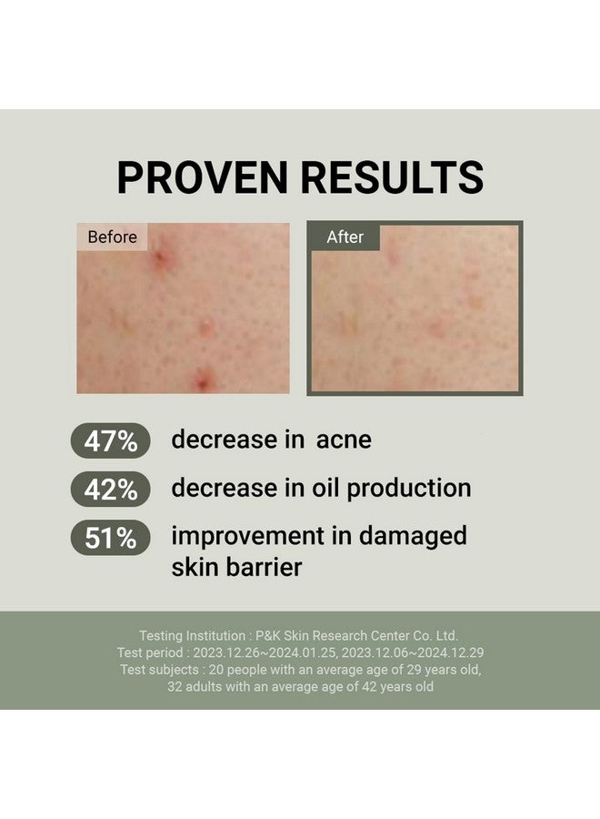 Snail Mucin 88 + Peptide Cream 100Ml Kbeauty For Sensitive Skin Calming Acne Strengthening Skin Barrier Controlling Oil