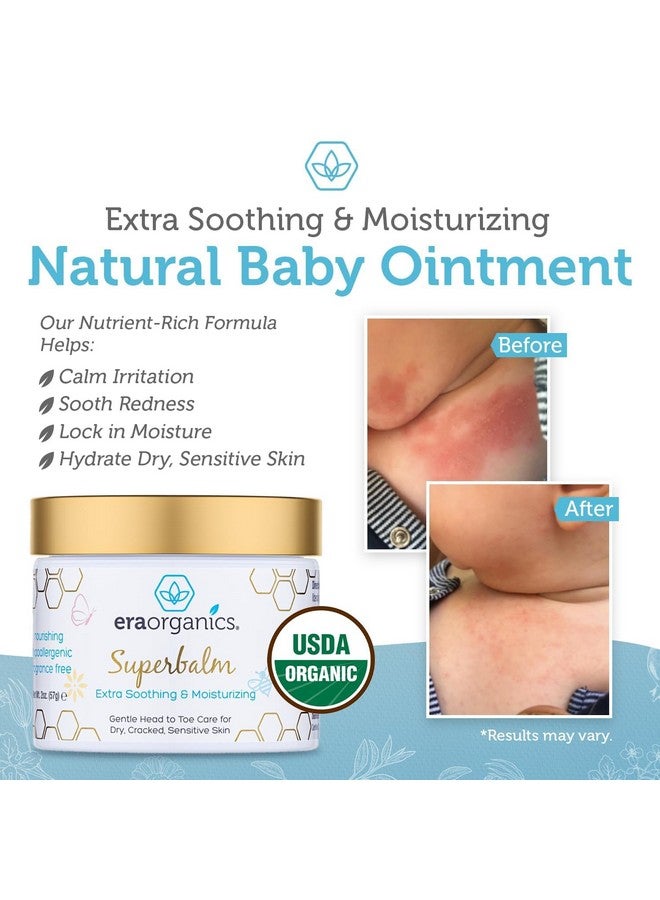 Healing Ointment For Babies Usda Certified Organic Natural Gentle Moisturizer For Sensitive Skin Prone To Baby Eczema Cradle Cap (Infant Seborrheic Dermatitis) Rashes Hives & More