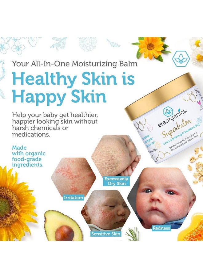 Healing Ointment For Babies Usda Certified Organic Natural Gentle Moisturizer For Sensitive Skin Prone To Baby Eczema Cradle Cap (Infant Seborrheic Dermatitis) Rashes Hives & More