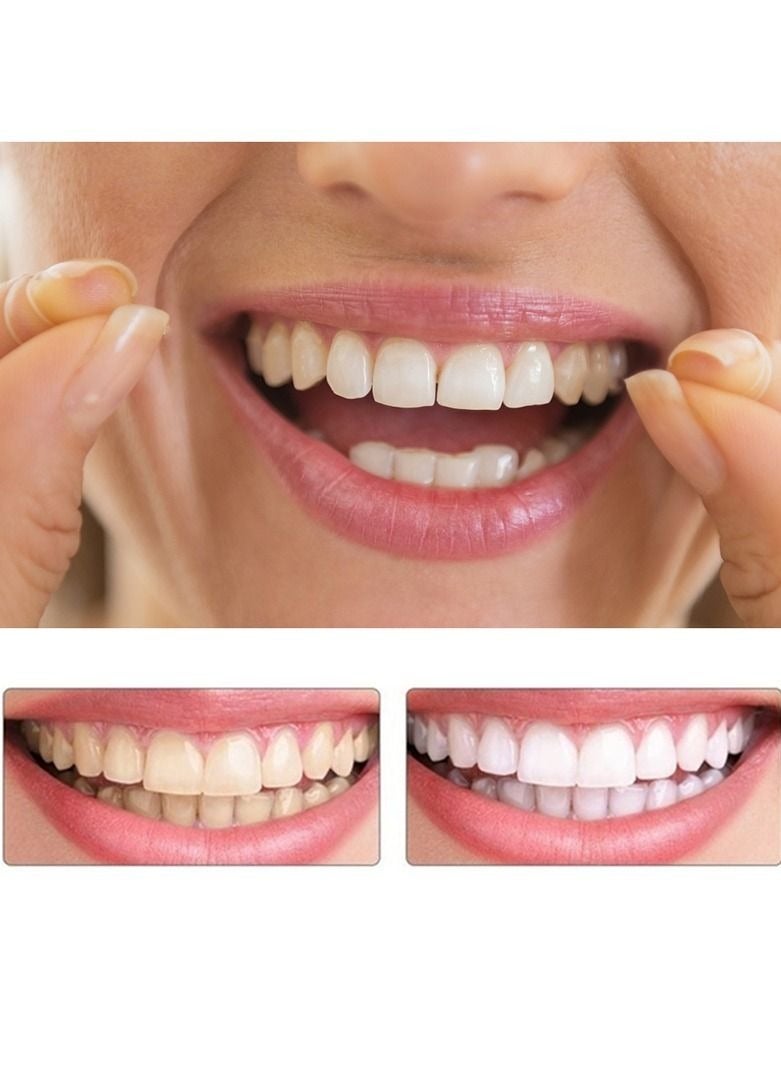 Teeth Veneers Anti-true Braces Snap On Smile Teeth Whitening Denture Teeth Comfortable Veneer Cover Teeth