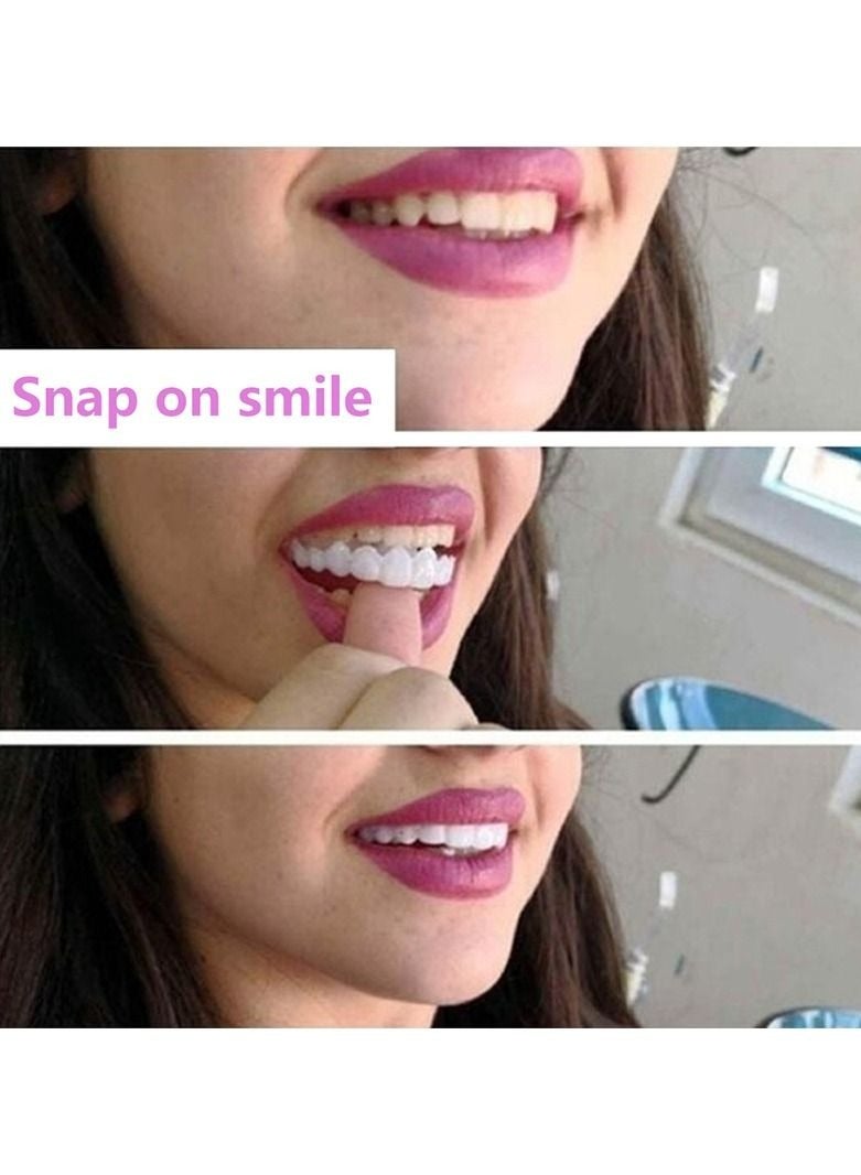 Teeth Veneers Anti-true Braces Snap On Smile Teeth Whitening Denture Teeth Comfortable Veneer Cover Teeth