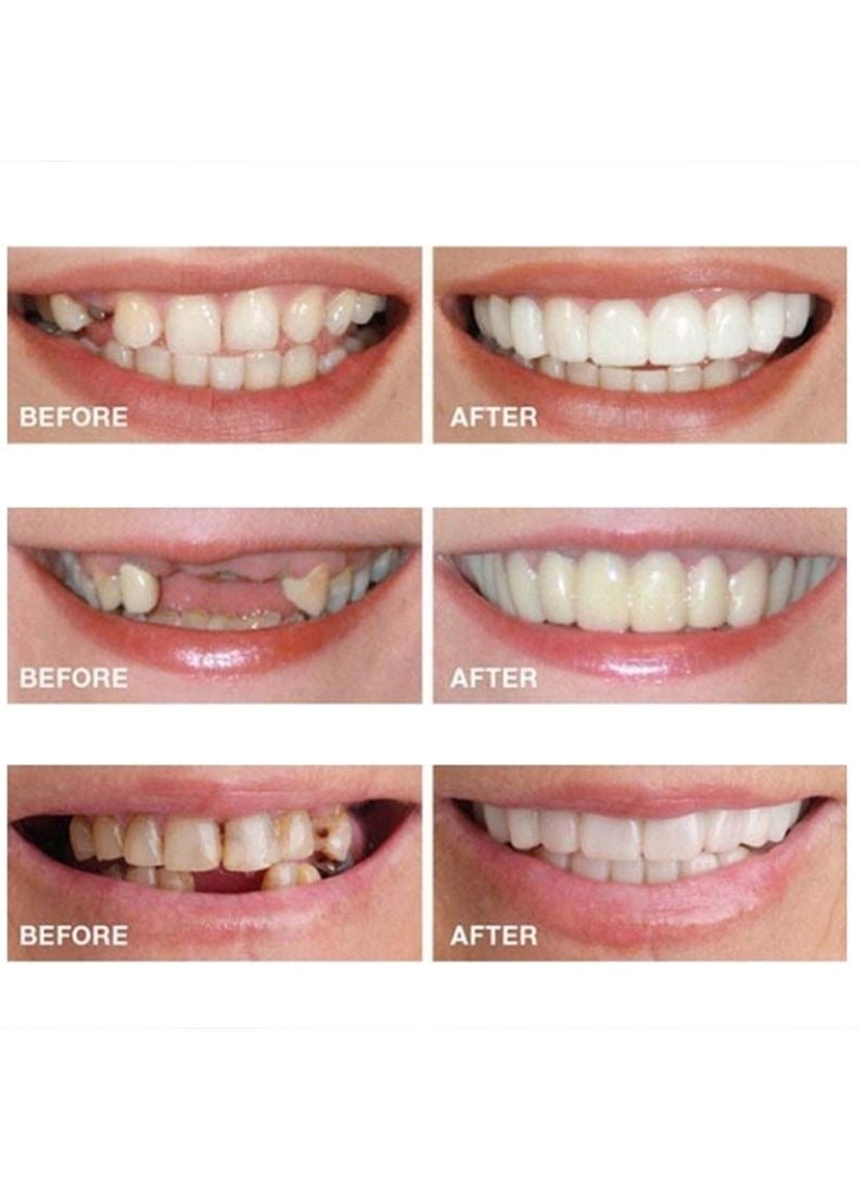 Teeth Veneers Anti-true Braces Snap On Smile Teeth Whitening Denture Teeth Comfortable Veneer Cover Teeth