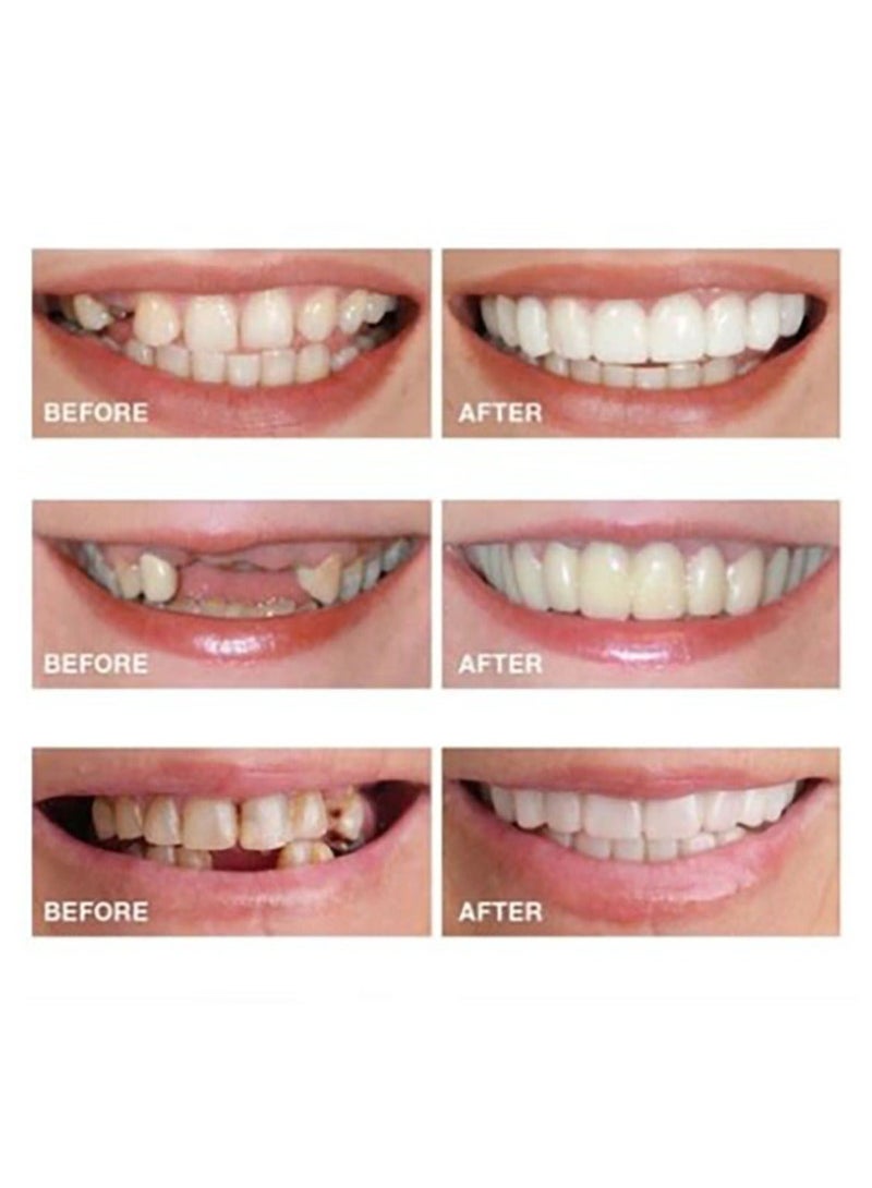 Teeth Veneers Anti-true Braces Snap On Smile Teeth Whitening Denture Teeth Comfortable Veneer Cover Teeth