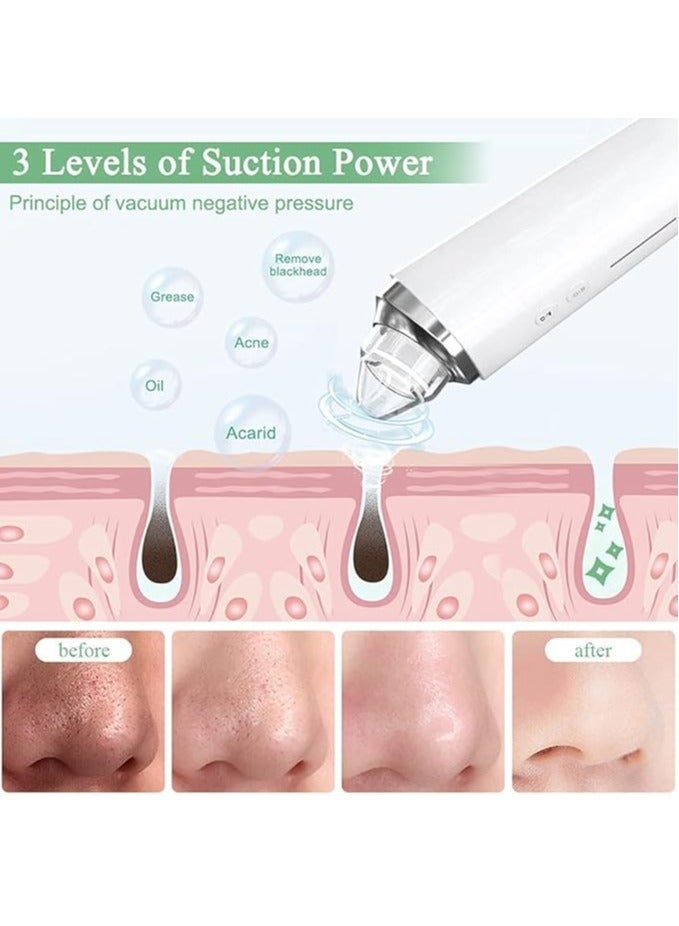 Blackhead Remover Pore Vacuum, WiFi Visible Facial Pore Cleanser With HD Camera Pimple Acne Comedone Extractor Kit With 6 Suction Heads Electric Blackhead