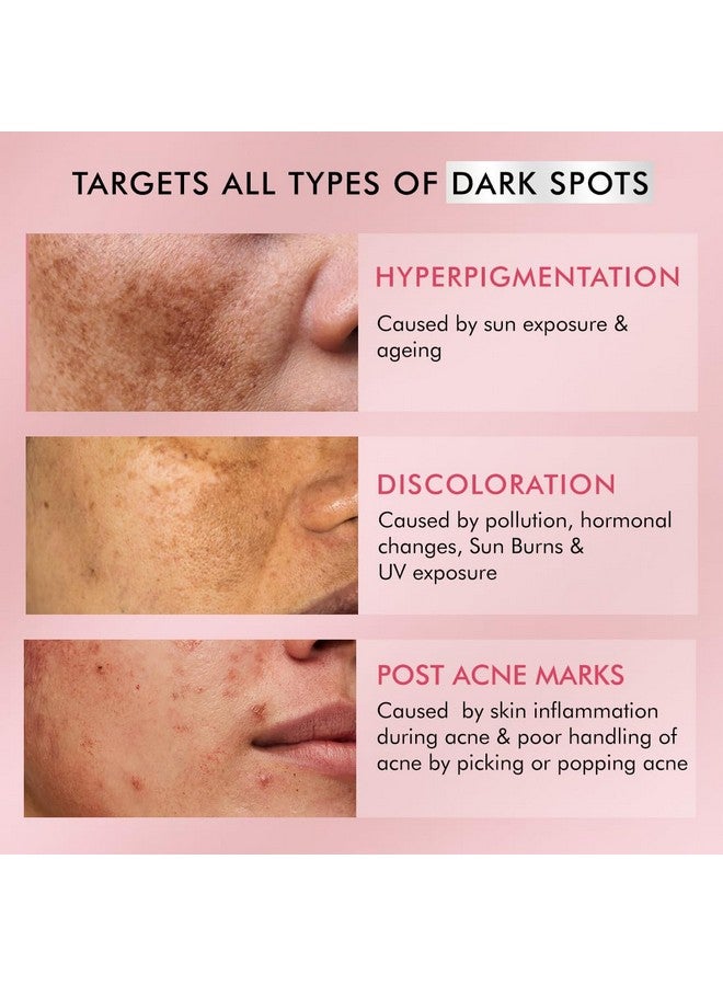 2% Kojic Acid & 1% Niacinamide Depigmentation Cream| Reduces Dark Spots Melasma Tan & Evens Skin Tone |Skin Brightening Lightweight Moisturizer For Men & Women | For All Skin Types 50G