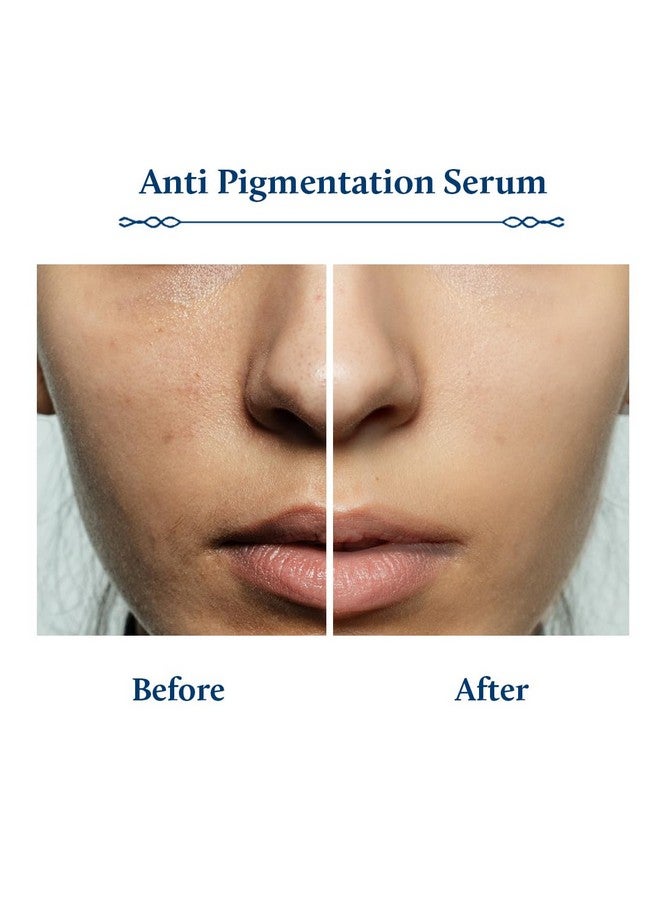 Plant Based Kojic Acid Serum For Pigmentation & Dark Spots Removal | Antipigmentation Face Serum For Women & Men With Rice Water & Mushroom | Lightweight | All Skin Types (13 Herbs30Ml)