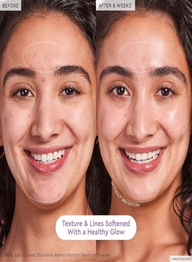 Glow Recipe Blackberry Retinol Blemish Serum - 30ml / 1oz | Clarifying & Smoothing Face Serum
