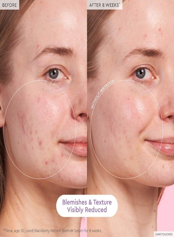 Glow Recipe Blackberry Retinol Blemish Serum - 30ml / 1oz | Clarifying & Smoothing Face Serum