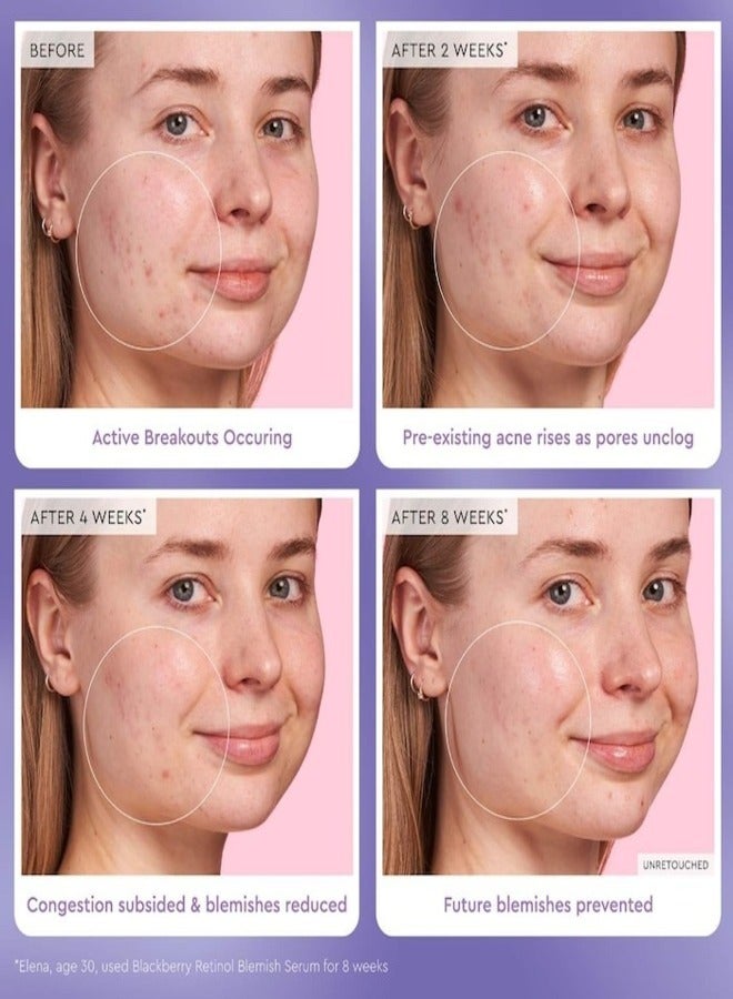 Glow Recipe Blackberry Retinol Blemish Serum - 30ml / 1oz | Clarifying & Smoothing Face Serum